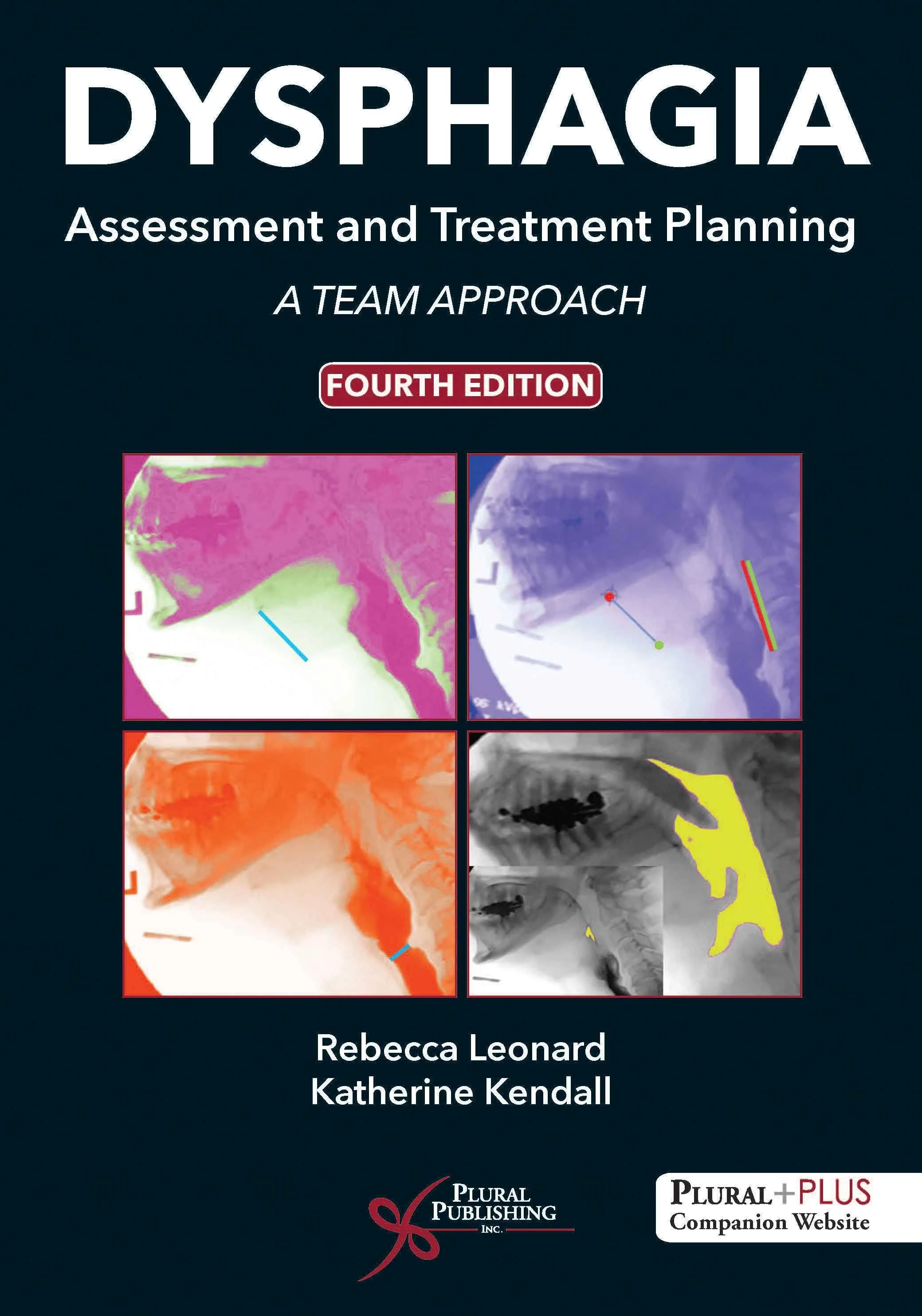 Dysphagia Assessment and Treatment Planning: A Team Approach [Book]