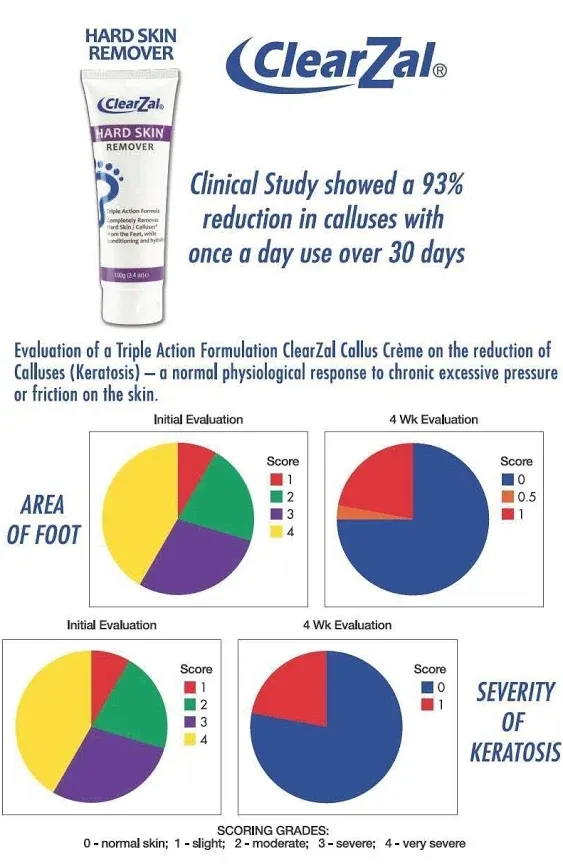 Clearzal Hard Skin Remover