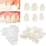 Brige Temporary Tooth Repair Kit for Filling The Missing Broken Tooth and Gaps Moldable Fake Teeth and Thermal Beads Replacement Kit