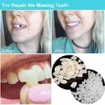 Brige Temporary Tooth Repair Kit for Filling The Missing Broken Tooth and Gaps Moldable Fake Teeth and Thermal Beads Replacement Kit