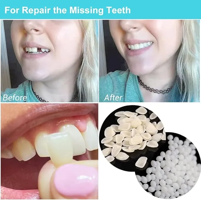 Brige Temporary Tooth Repair Kit