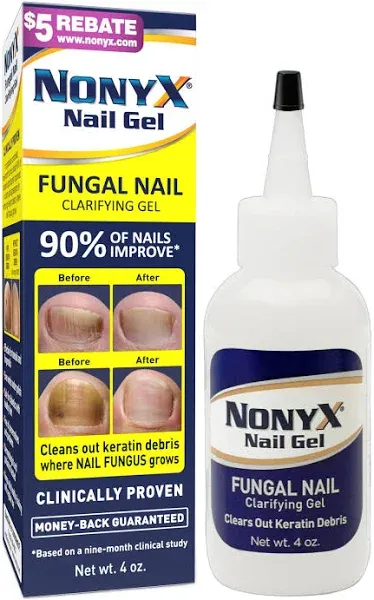 Nonyx Nail Gel, 4.0 OZ (2 Pack) 