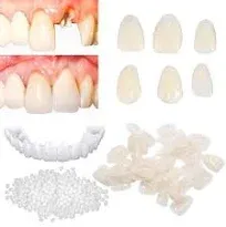 Brige Tooth Repair Kit for Fixing The Missing Chipped and Broken Tooth Gap Temporary Replacement Thermal Beads