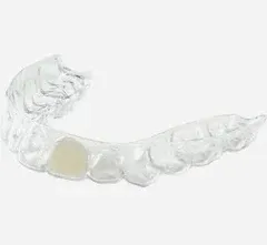 REORDER-Upper Partial Denture Retainer (1 Tooth Only)