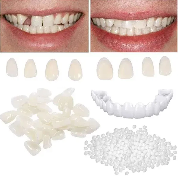 Temporary Tooth Repair kit for Filling The Missing Broken Tooth and Gaps-Mold