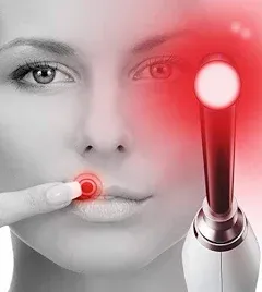 Luminance Red The Proven Canker Sore Device for Pain Relief and Mouth Sore Management