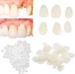 womcare Temporary Tooth Repair Kits for Filling The Missing Broken Tooth and Gaps Moldable Fake Teeth and Thermal Beads Replacement Kits