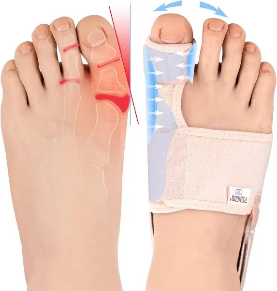 PEDIGOO Bunion Corrector for Women 2pc Non-Slip Bunion Toe Separator Hallux V...