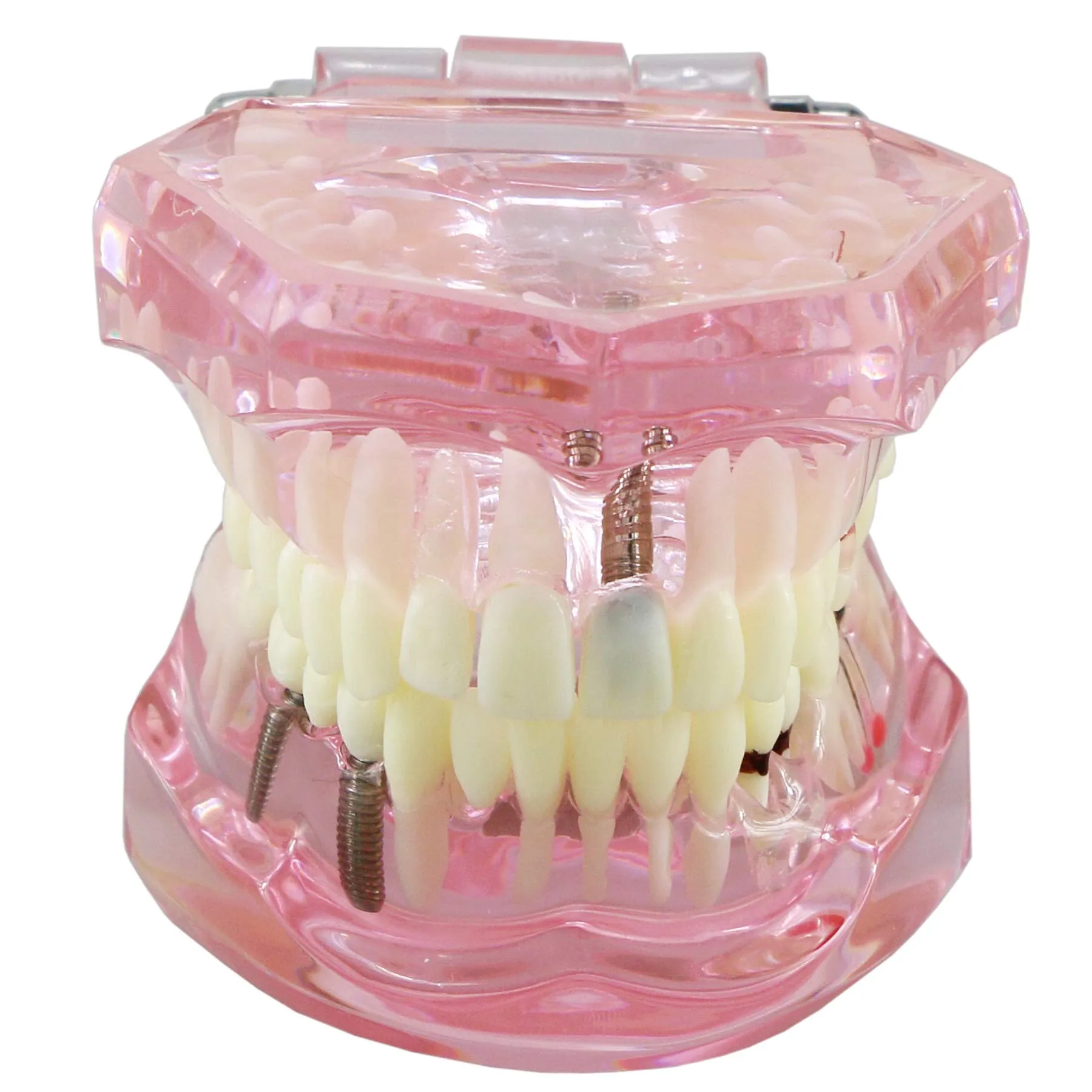 Dentalmall Dental Implant Study Analysis Demonstration Teeth