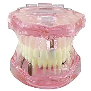 Dentalmall Dental Implant Study Analysis Demonstration Teeth