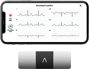 AliveCor Kardia Mobile 6L FDA Cleared- Mobile ECG device