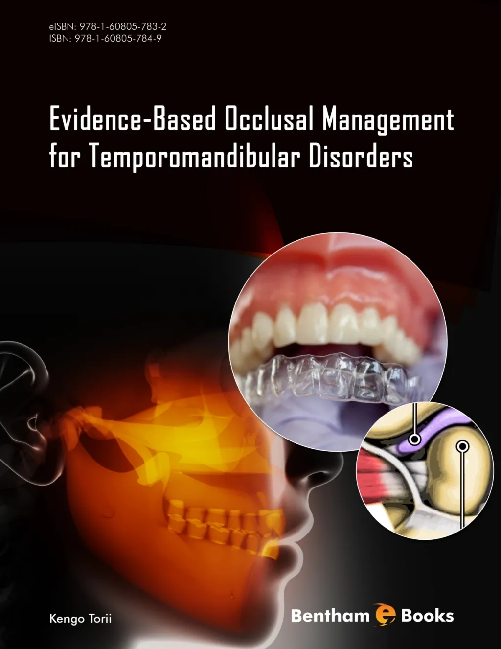 Management of Temporomandibular Disorders and Occlusion