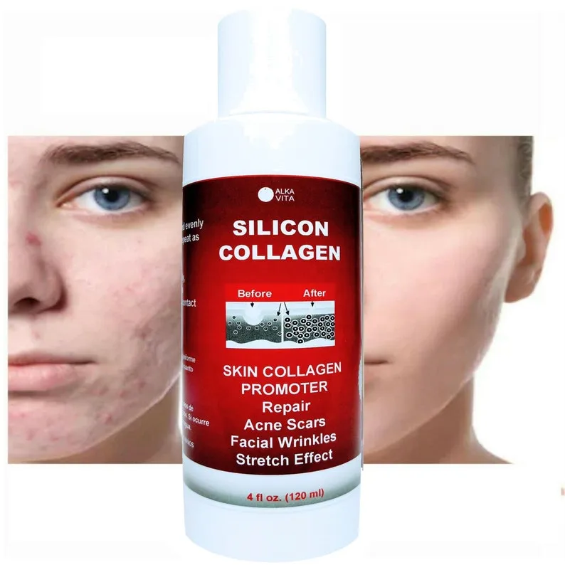 Acne Scars Silicon Collagen Gel Promoter Gel Resurfacing Indented Skin ALKAVITA