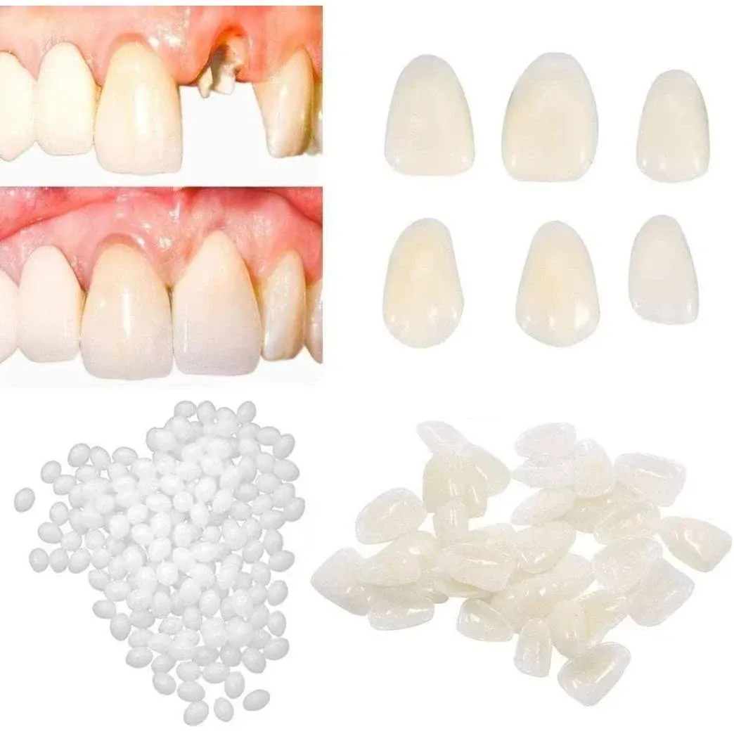 womcare Fake Tooth Repair Kits for Filling The Missing Broken Tooth and Gaps-Moldable and False Teeth Thermal Beads Replacement Kits