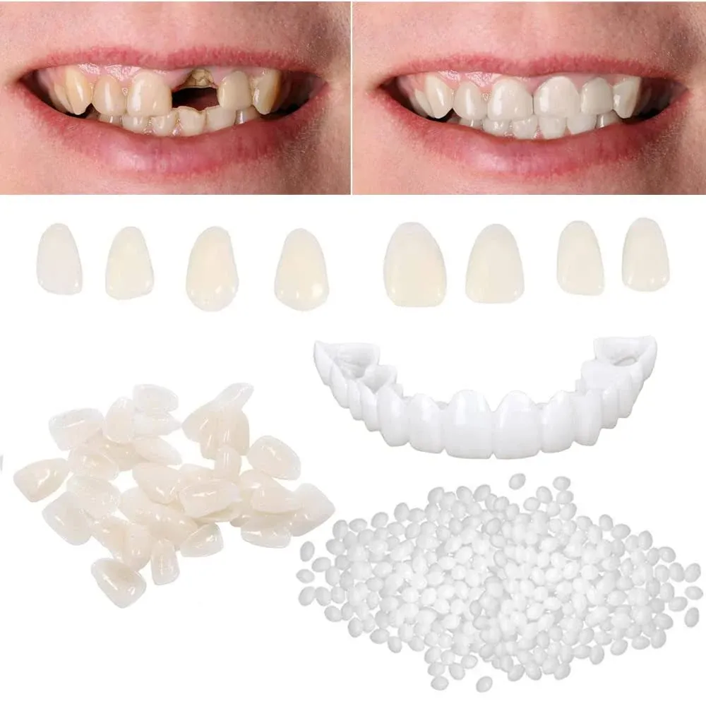 Brige Tooth Repair Kit for Fixing The Missing Chipped and Broken Tooth Gap Temporary Replacement Thermal Beads