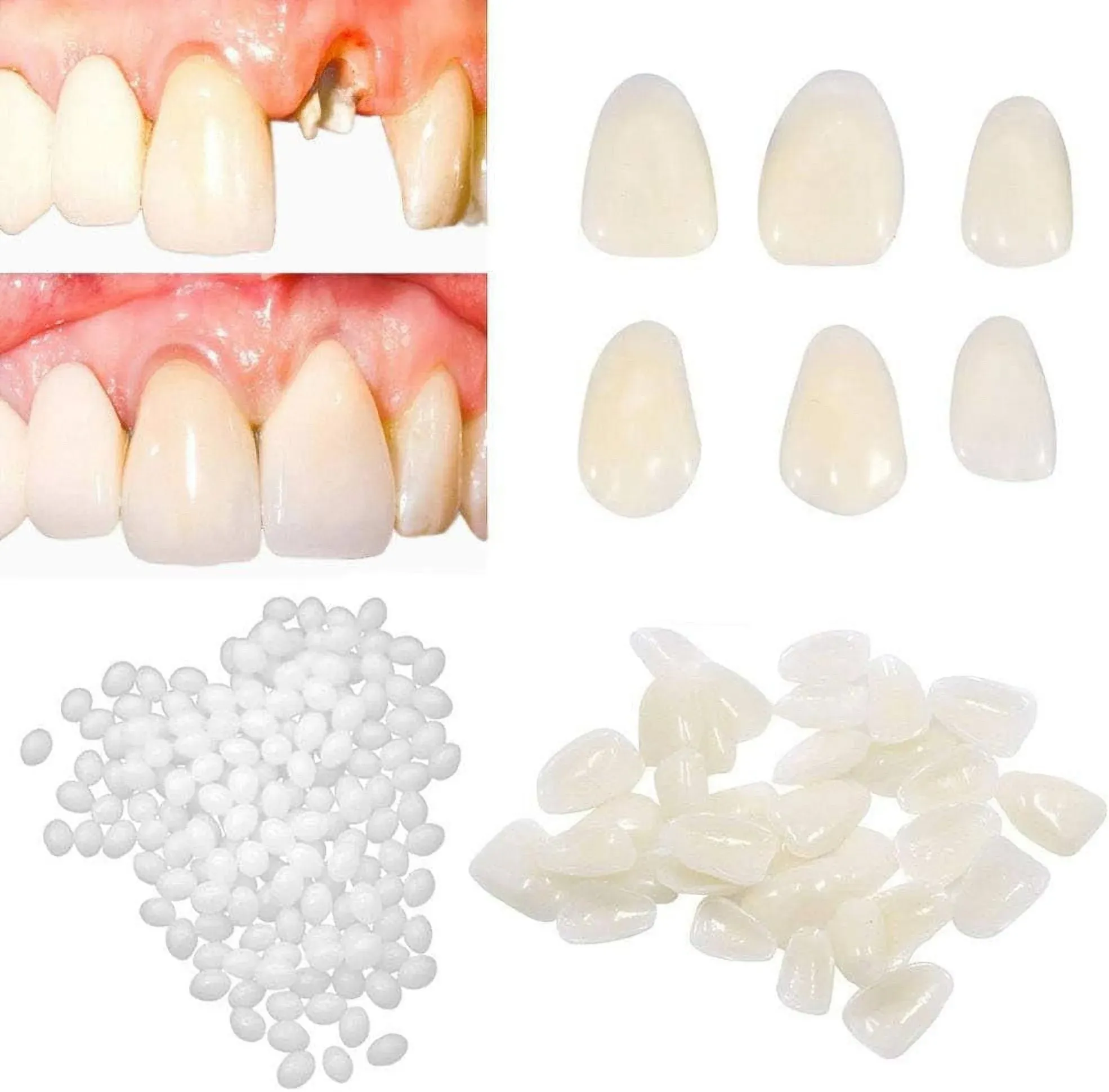 Temporary Tooth Repair kit for Filling The Missing Broken Tooth and Gaps-Mold...