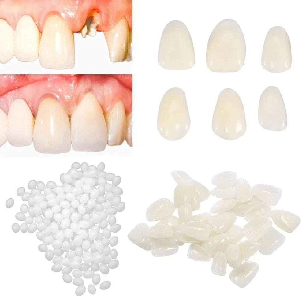 Brige Temporary Tooth Repair kit for Filling The Missing Broken Tooth