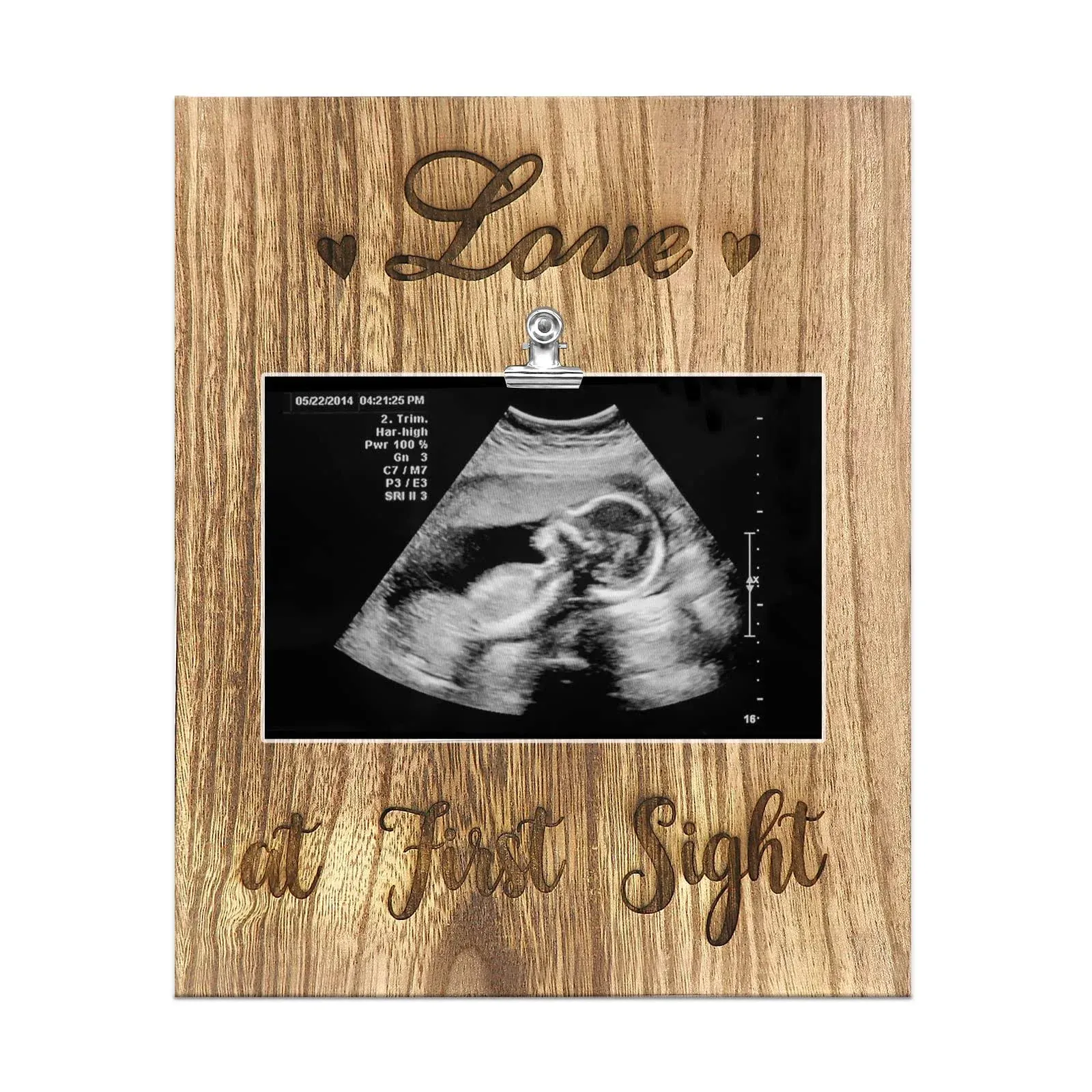 Sonogram Picture Frame， Keepsake Baby Ultrasound Frame，Love at First Sight，St...