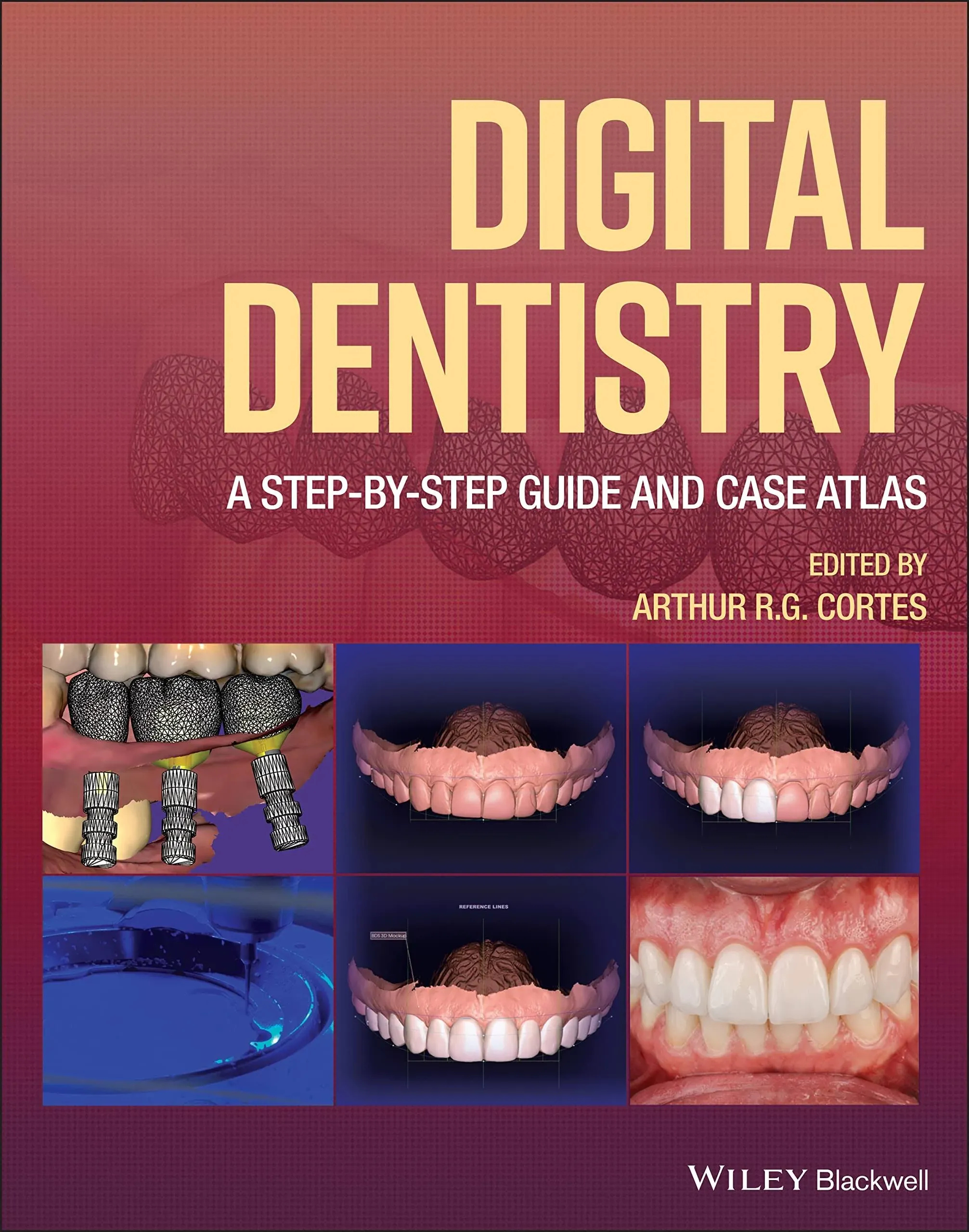 Digital Dentistry A Step By Step Guide And Case Atlas (Hb 2022) by Cortes A.R.G - from indianaabooks (SKU: 9781119851998)