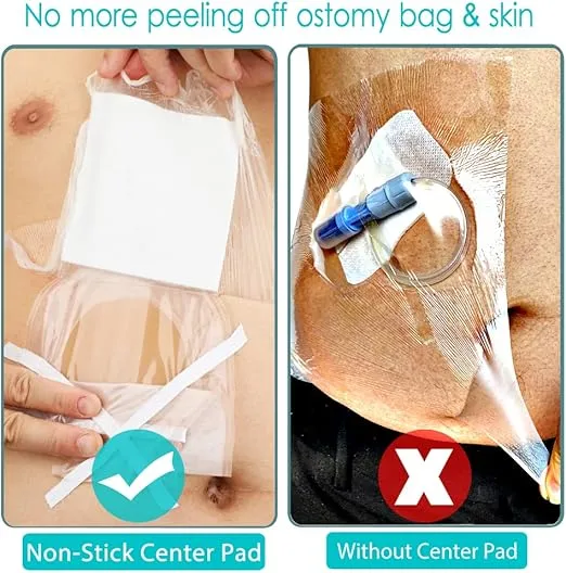 Waterproof Ostomy Bag Shower Cover with Non Sticky Pad Colostomy Ilostomy Urlostomy Pouch Shower Guard Shield 10x12, 7pc