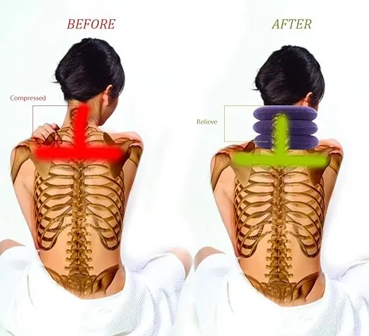 Cervical Neck Traction Device Inflatable Neck Stretcher, Easy to Use for Chronic Neck and Shoulder Pain Relief Traction Spine Alignment, Neck Cervical Brace