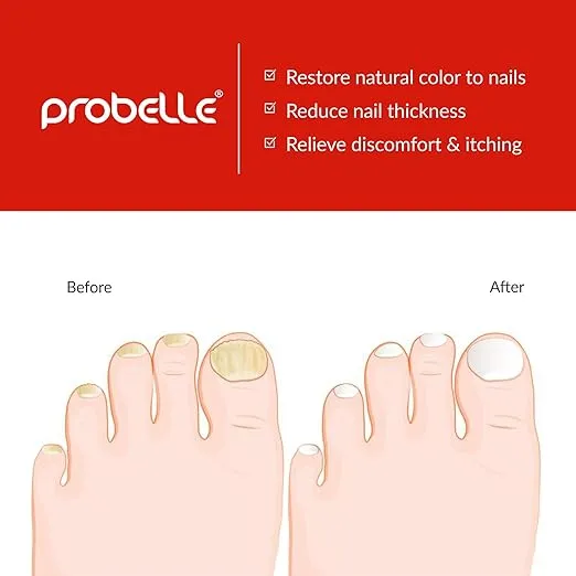 Probelle Natural Fungal Nail Oil, Nail Color Restoration, Clear Topical Solution .5 oz/ 15 ml