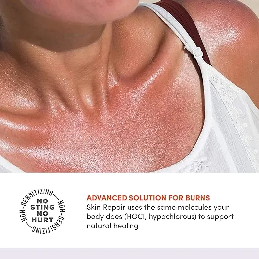 Active Skin Repair First Aid Skin Healing Burn Hydrogel - Natural, Non-Toxic, & No Sting Skin Burn Ointment with Hypochlorus Acid for Immediate Pain Relief, HSA/FSA Eligible, 3 oz